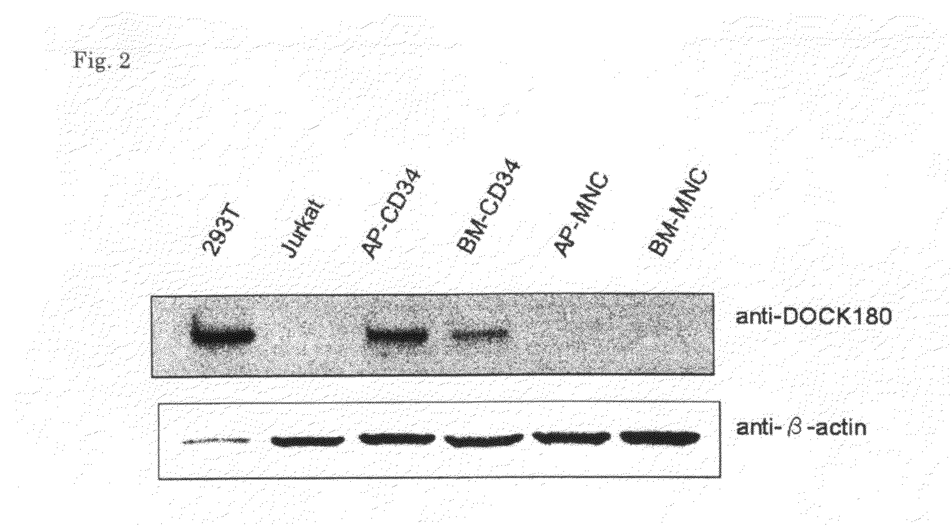 Method of detecting leukemic cell