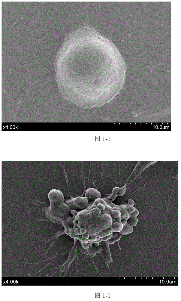 Preparation method of coix seed polysaccharide and application of coix seed polysaccharide