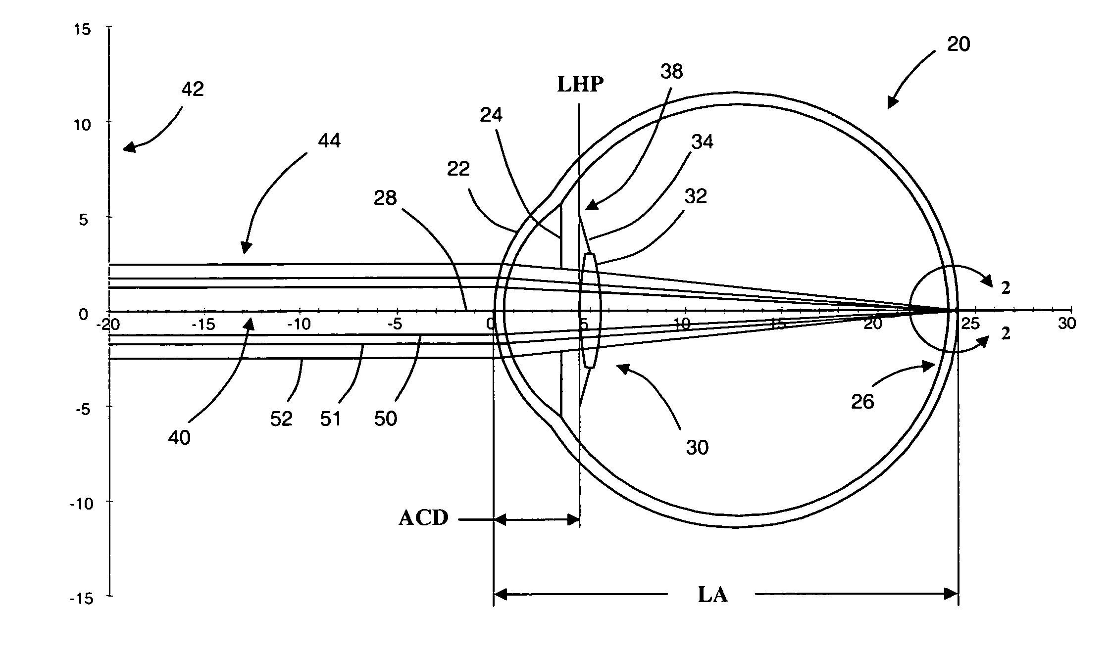 Devices and methods of selecting intraocular lenses