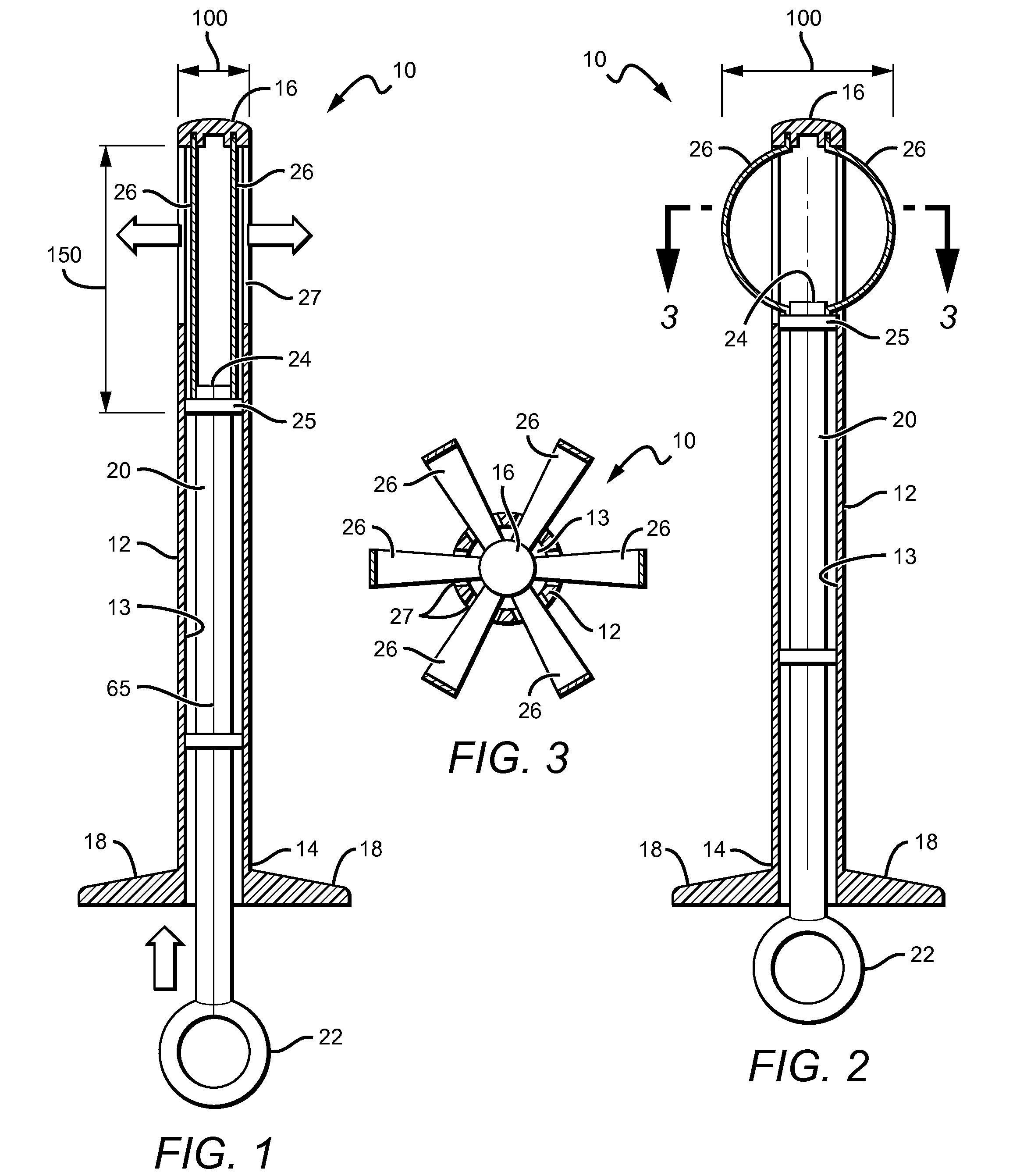 Betts Osteotome