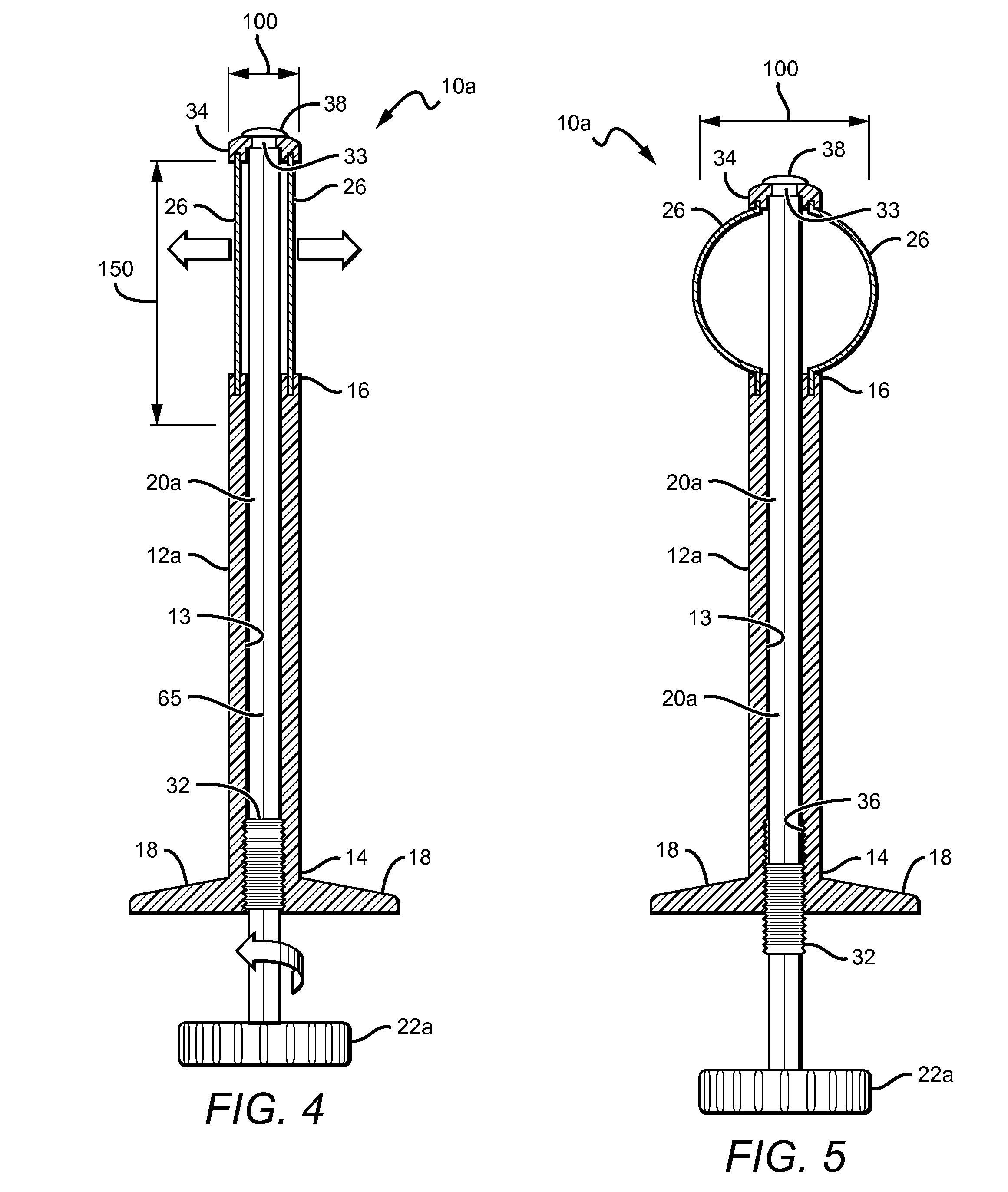 Betts Osteotome