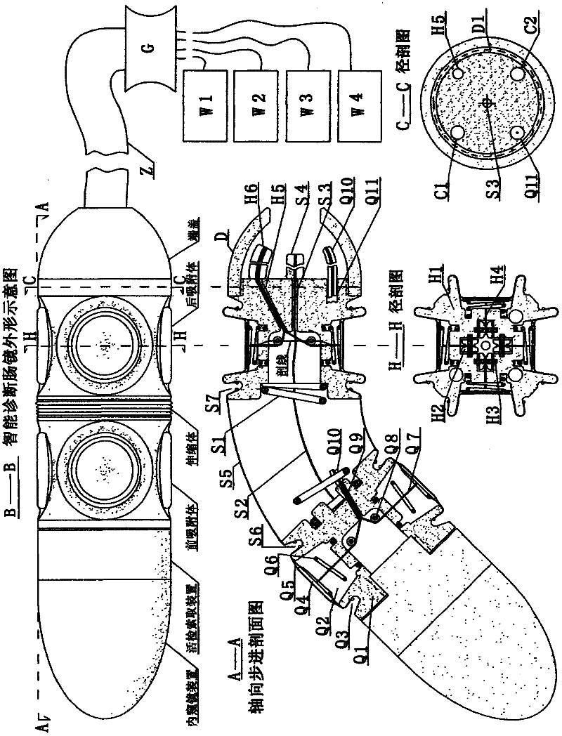 Intelligent diagnostic enteroscope