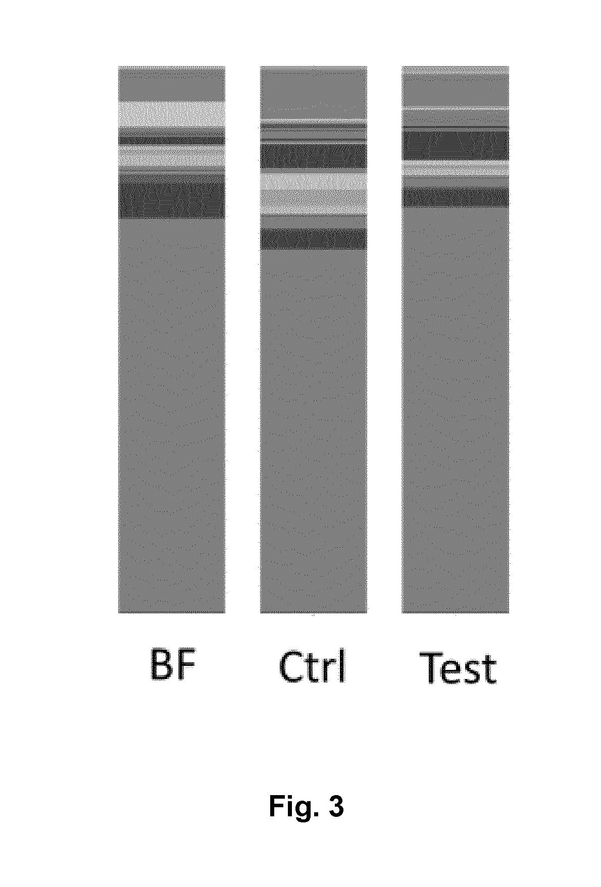 Nutritional compositions with 2fl and lnnt for use in preventing and/or treating non-rotavirus diarrhea by acting on the gut microbiota dysbiosis