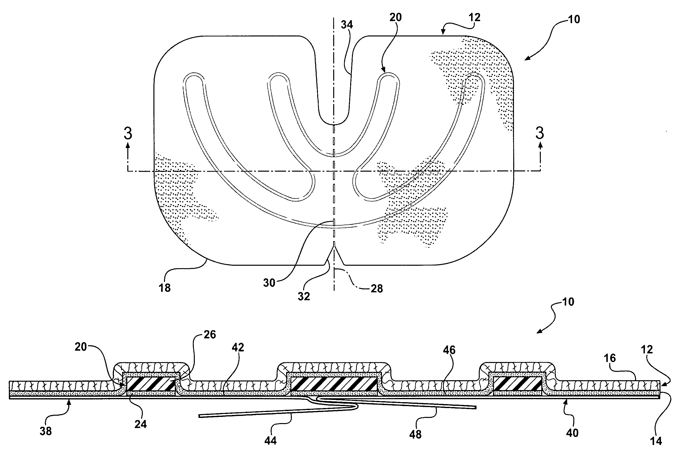 Reinforced closure anchor