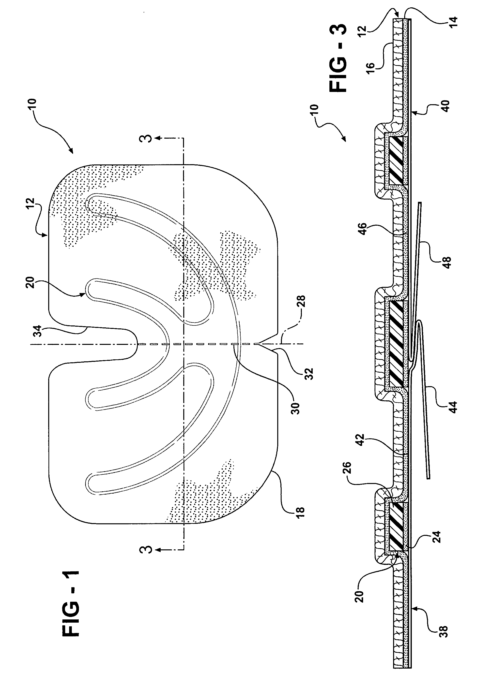 Reinforced closure anchor