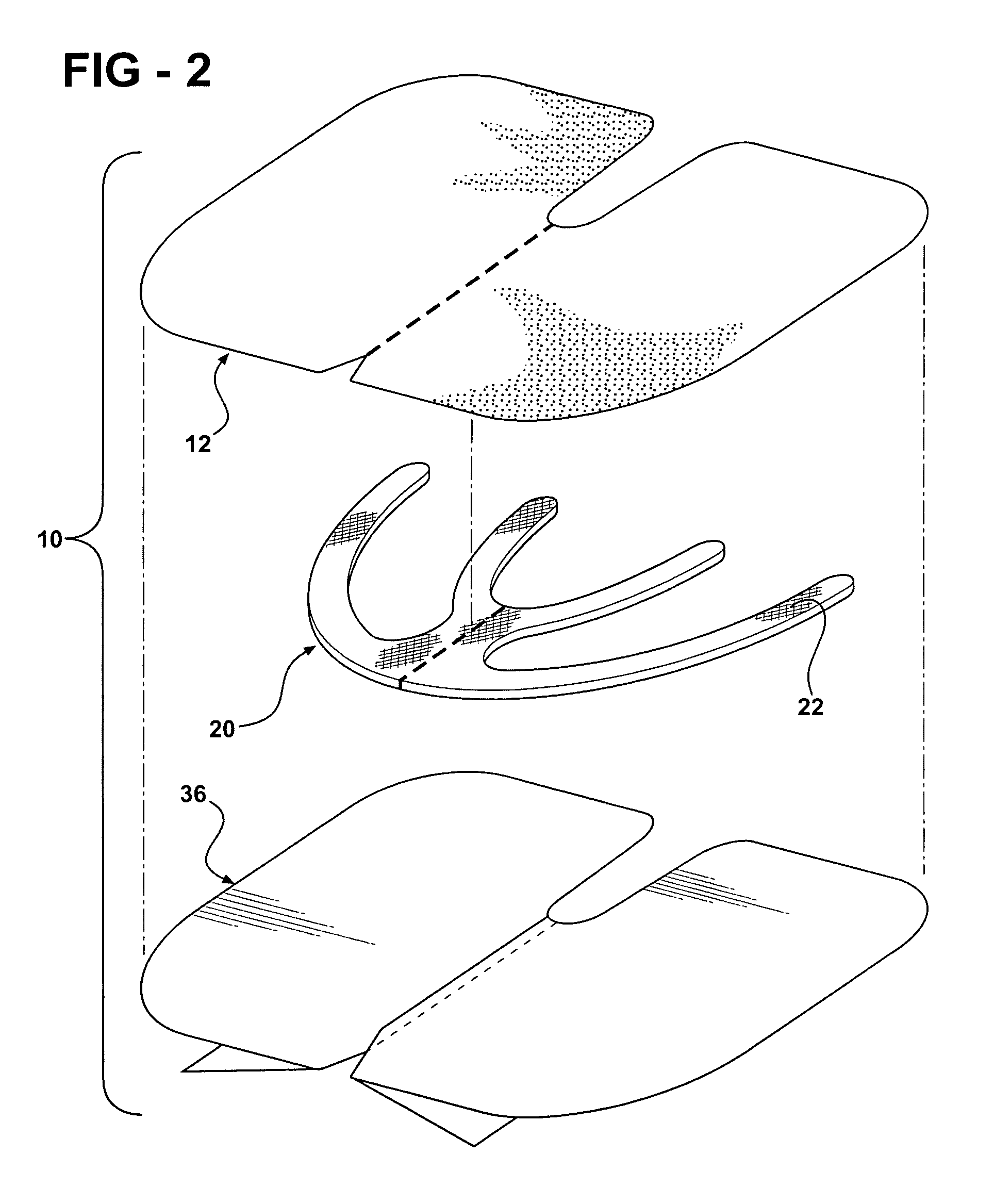 Reinforced closure anchor