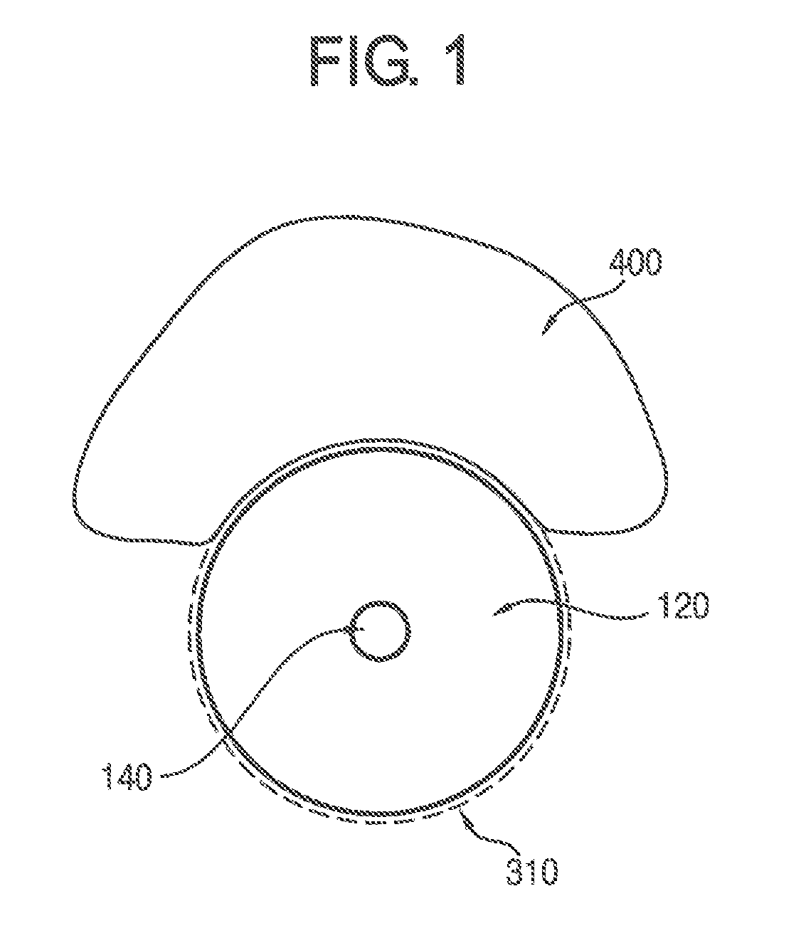 Triple endorectal ballooning system for prostate cancer radiotherapy