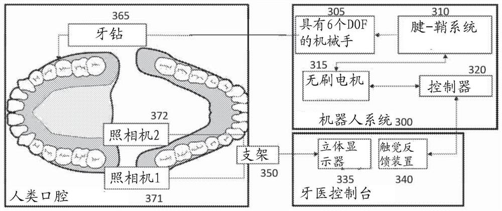 A compact dental robotic system