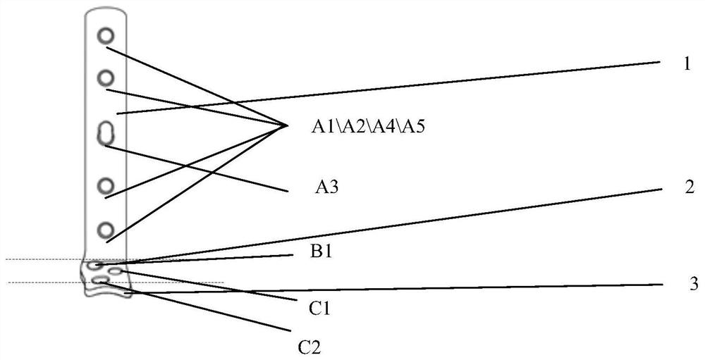 Anatomy, locking, compression internal fixation device for anterior tibiotalar joint fusion