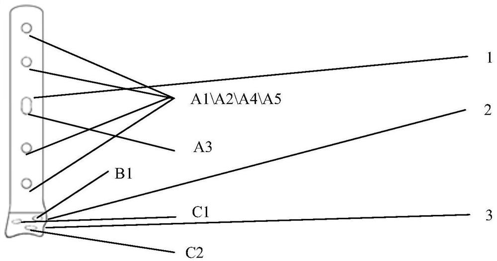 Anatomy, locking, compression internal fixation device for anterior tibiotalar joint fusion