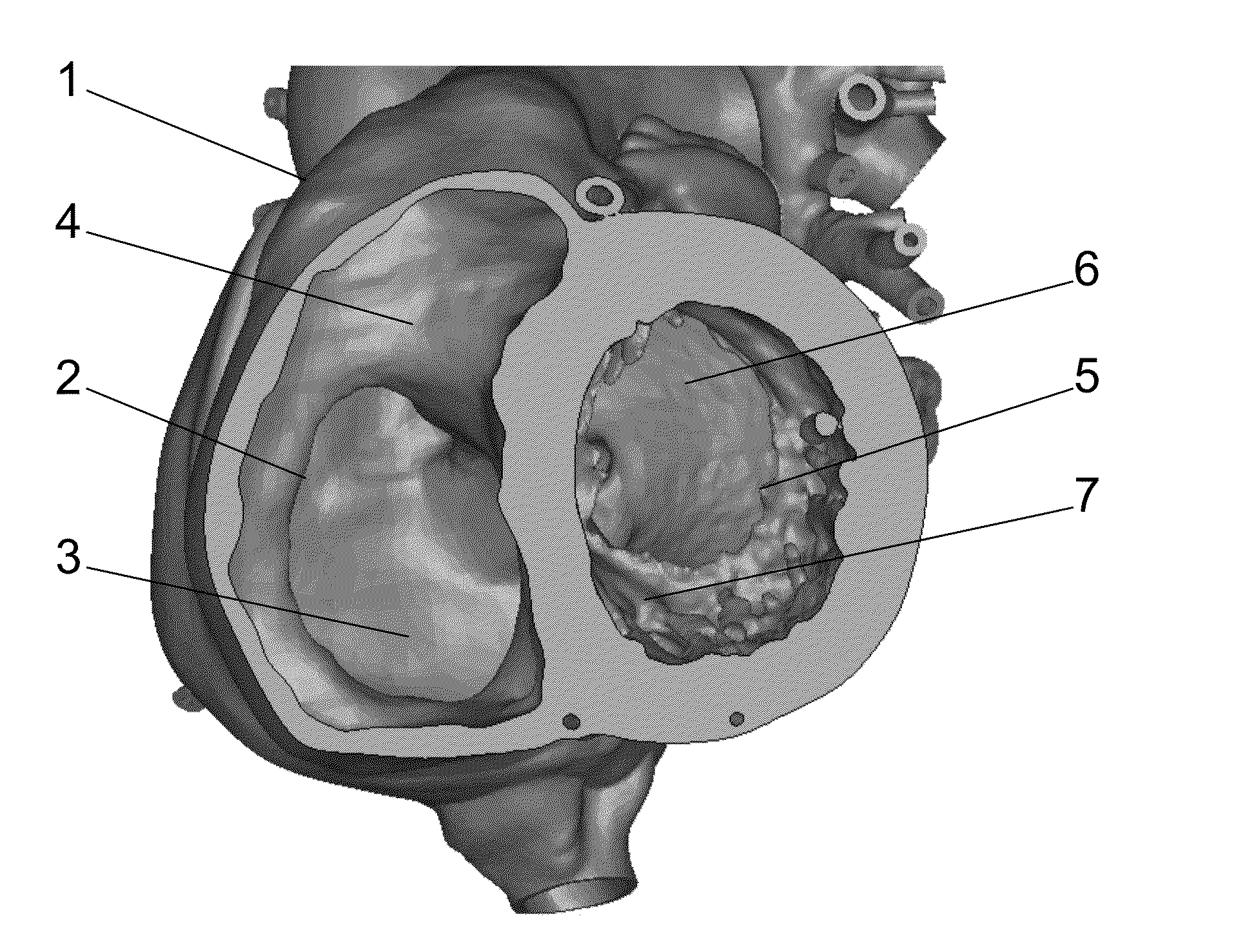 Patient-specific intraluminal implants