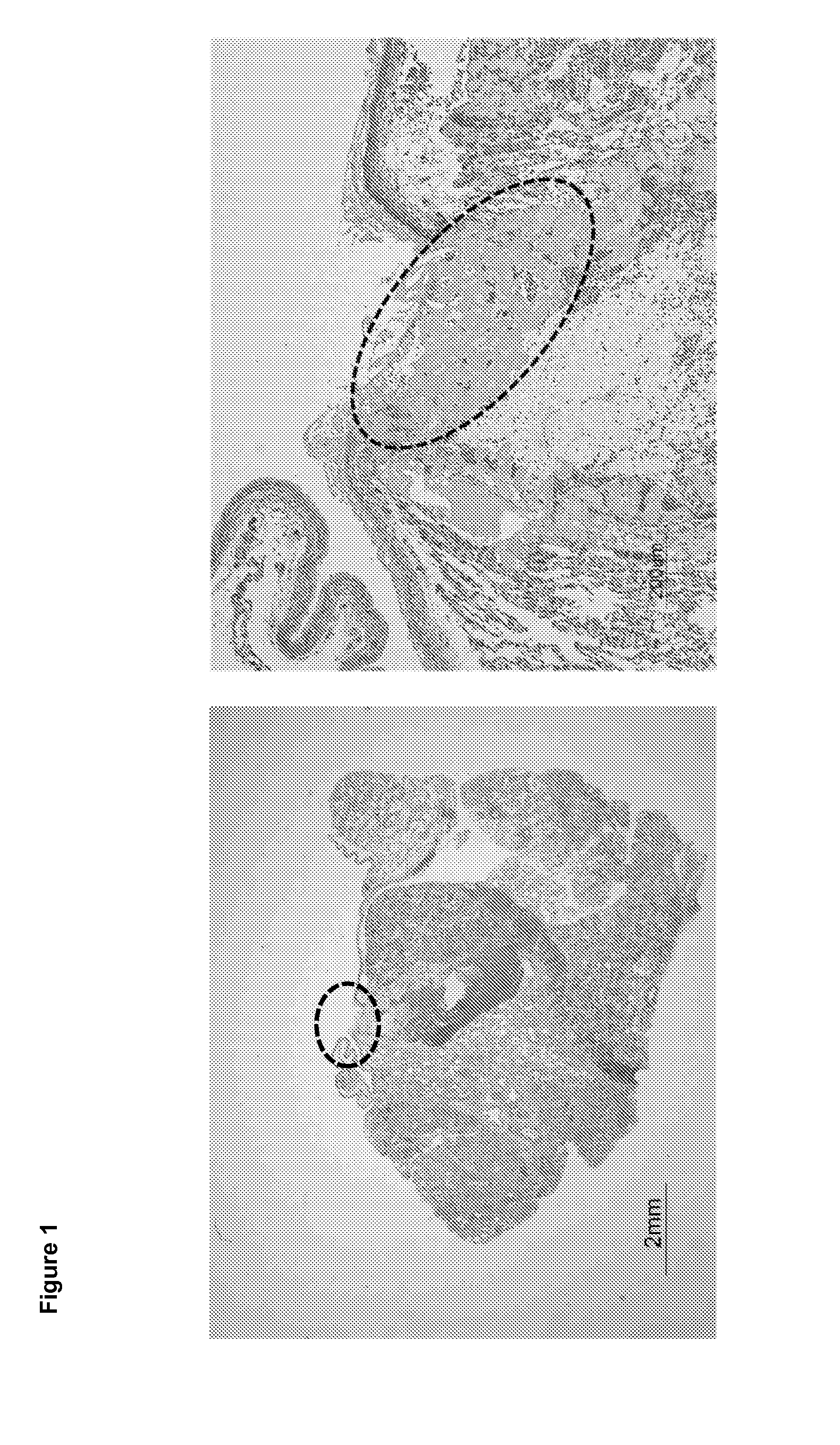 Amphiphilic Peptides for Thoracic Air Leakage Occlusion