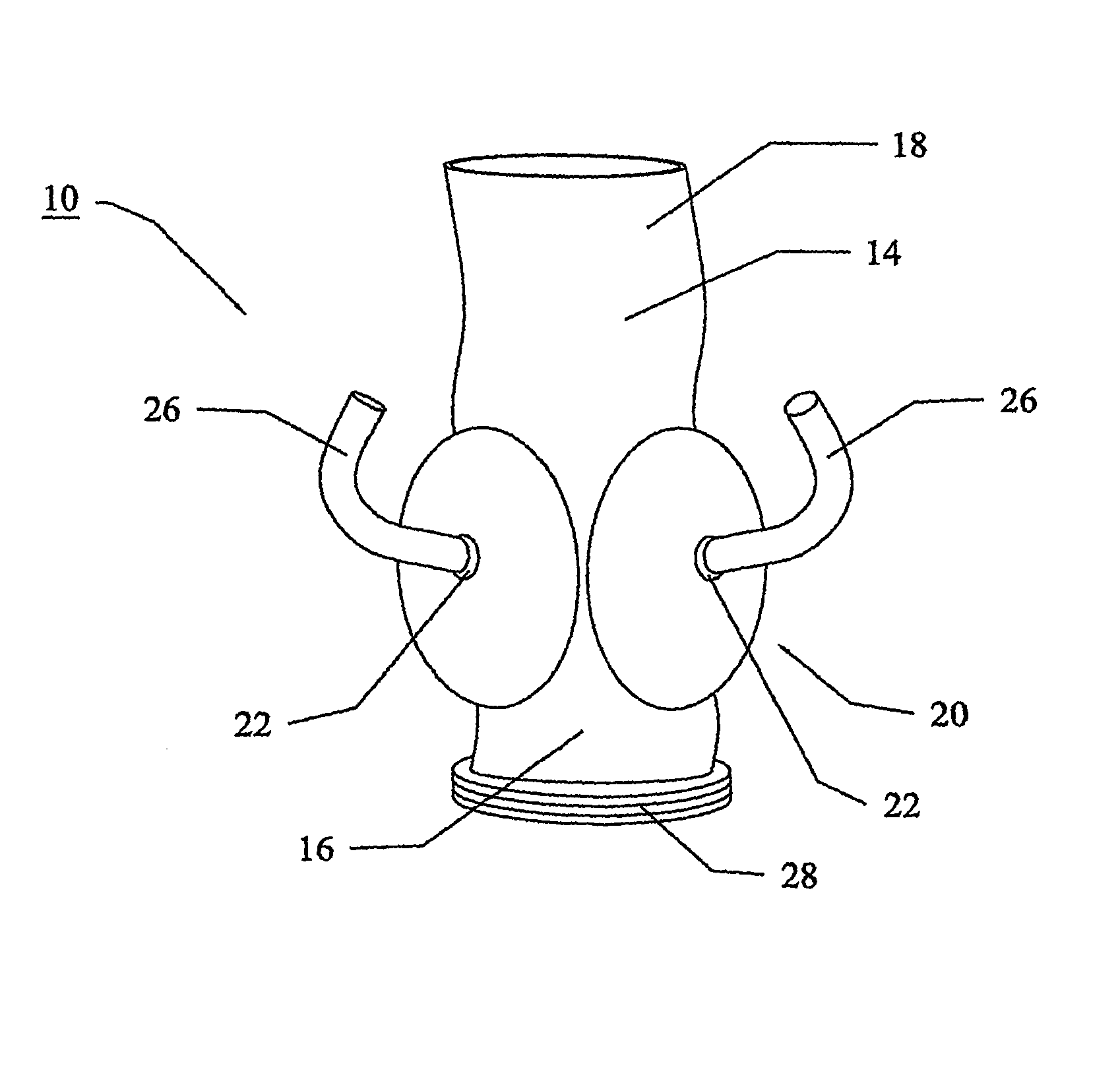 Vascular prosthesis