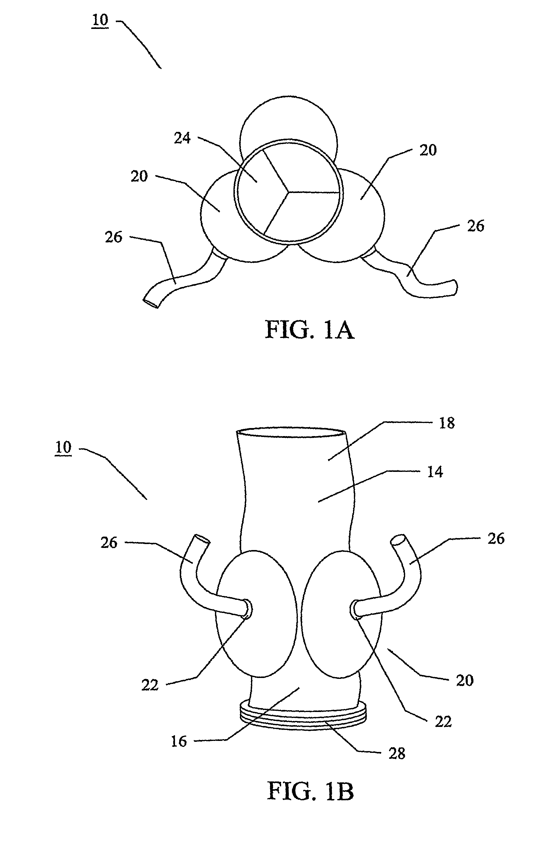 Vascular prosthesis