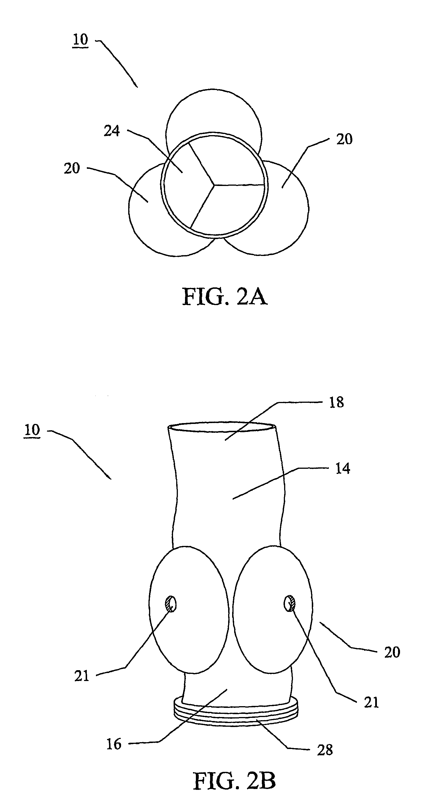 Vascular prosthesis