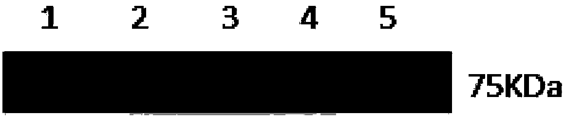 CD8+T cell epitope polypeptide of S1 protein of chicken IBV (Infectious Bronchitis Virus) S1 protein