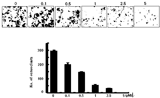 Pharmaceutical application of caffeic acid 3, 4-dihydroxyl phenethylester