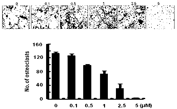 Pharmaceutical application of caffeic acid 3, 4-dihydroxyl phenethylester