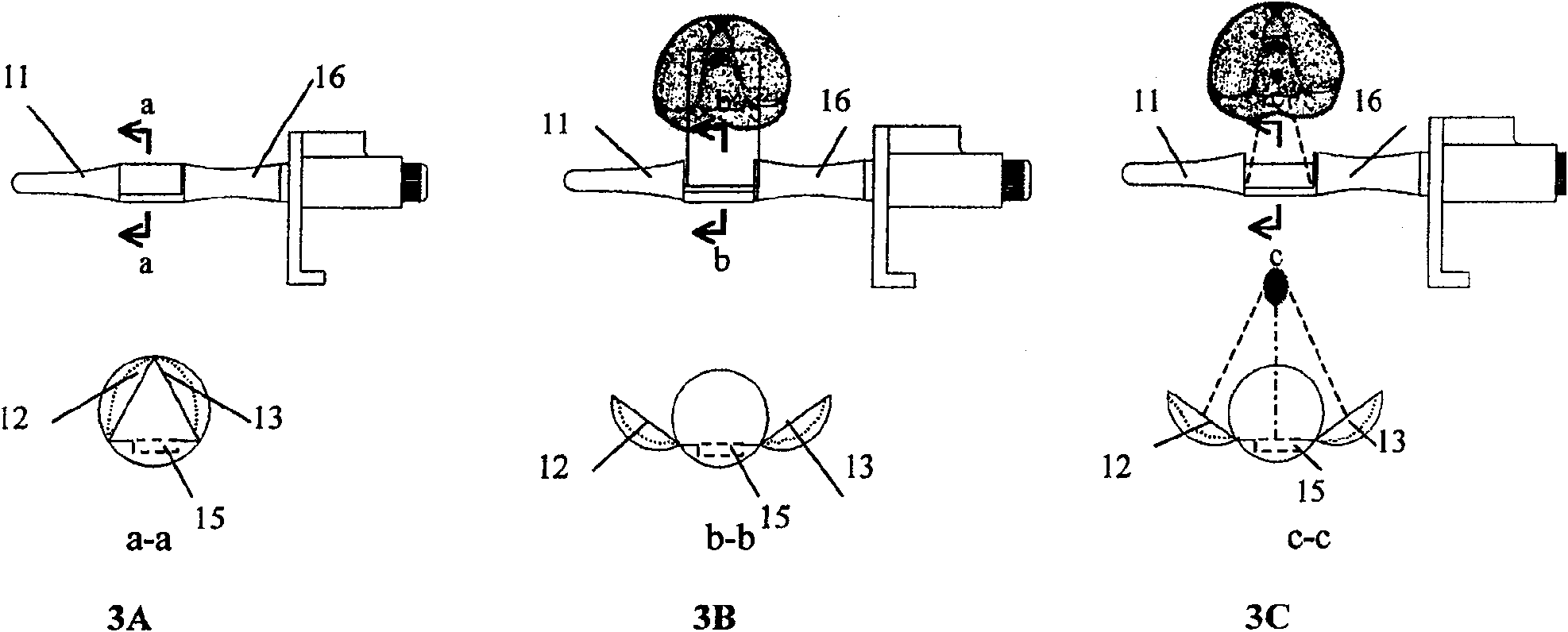 Ultrasonic device for treating prostate disease