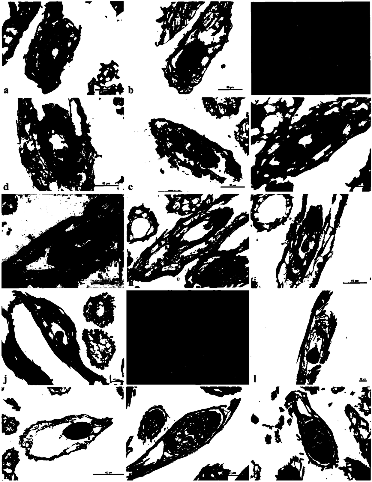 Method for promoting aseptic germination of Dendrobium officinale and culture medium used therein, and application of method