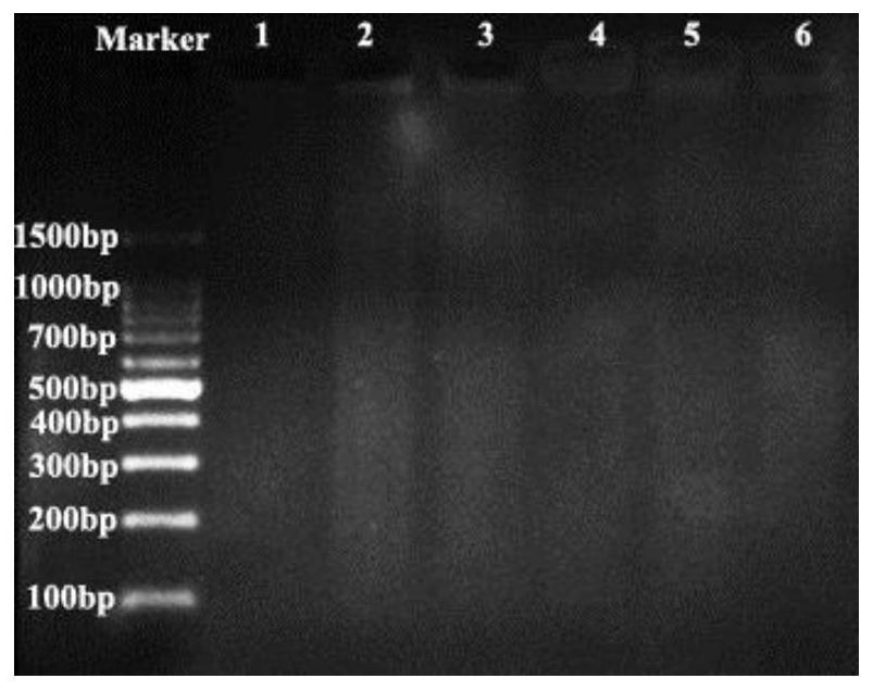 A uveal melanoma metastasis risk prediction kit