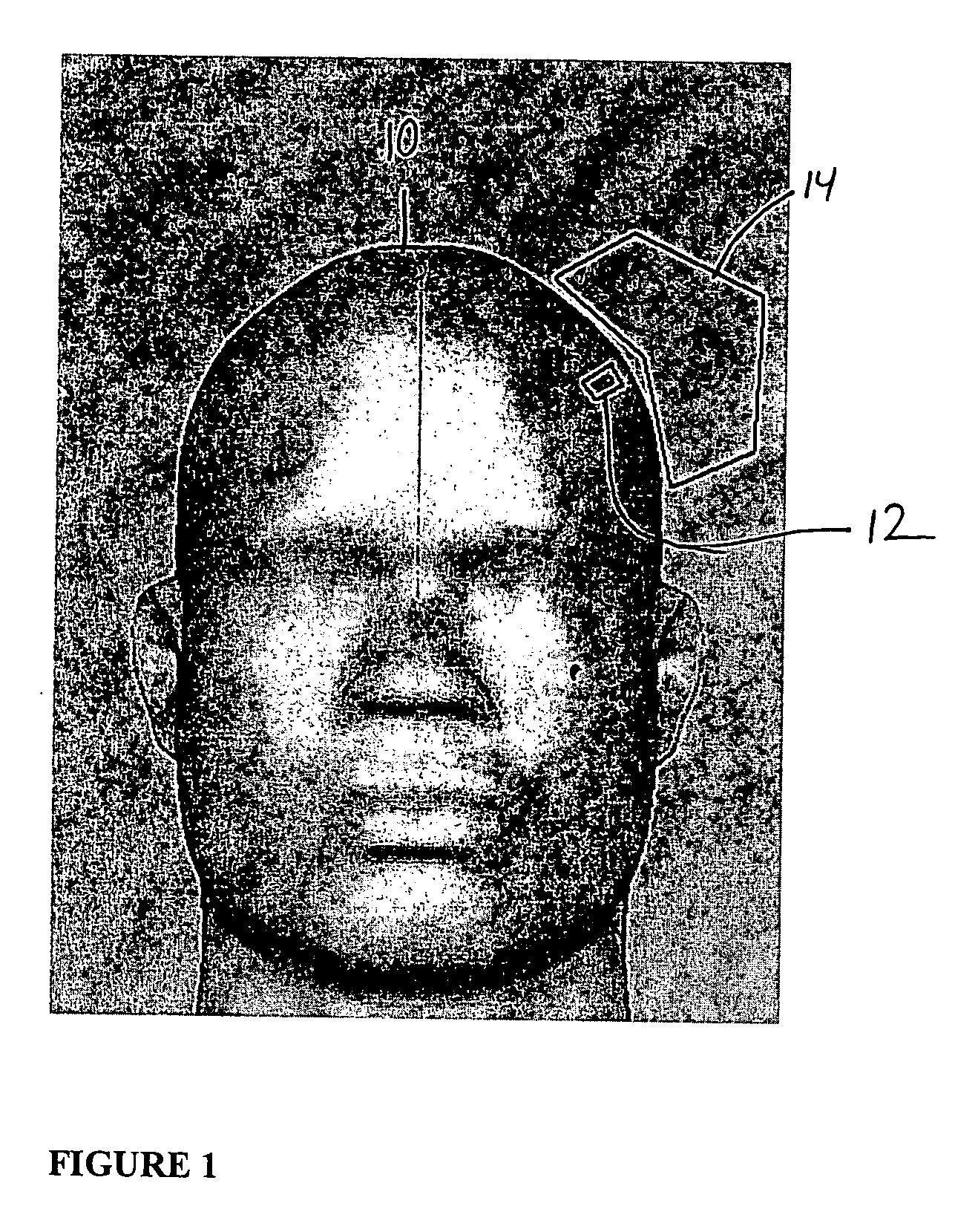 Head phantom for simulating the patient response to magnetic stimulation