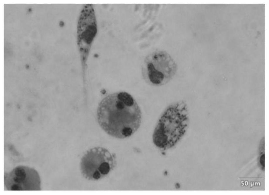 Application of micro-nano MgH2 compound particles in inhibiting leishmania infection and treating leishmania disease