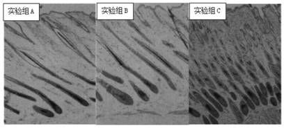 Compound external preparation for preventing and treating alopecia and promoting hair growth