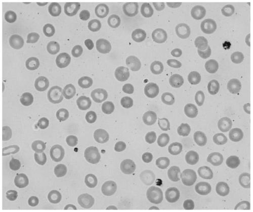 Single-cell hemoglobin determination method and device based on image processing