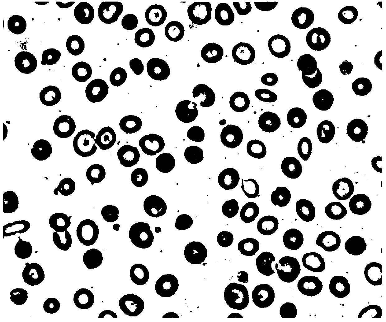 Single-cell hemoglobin determination method and device based on image processing