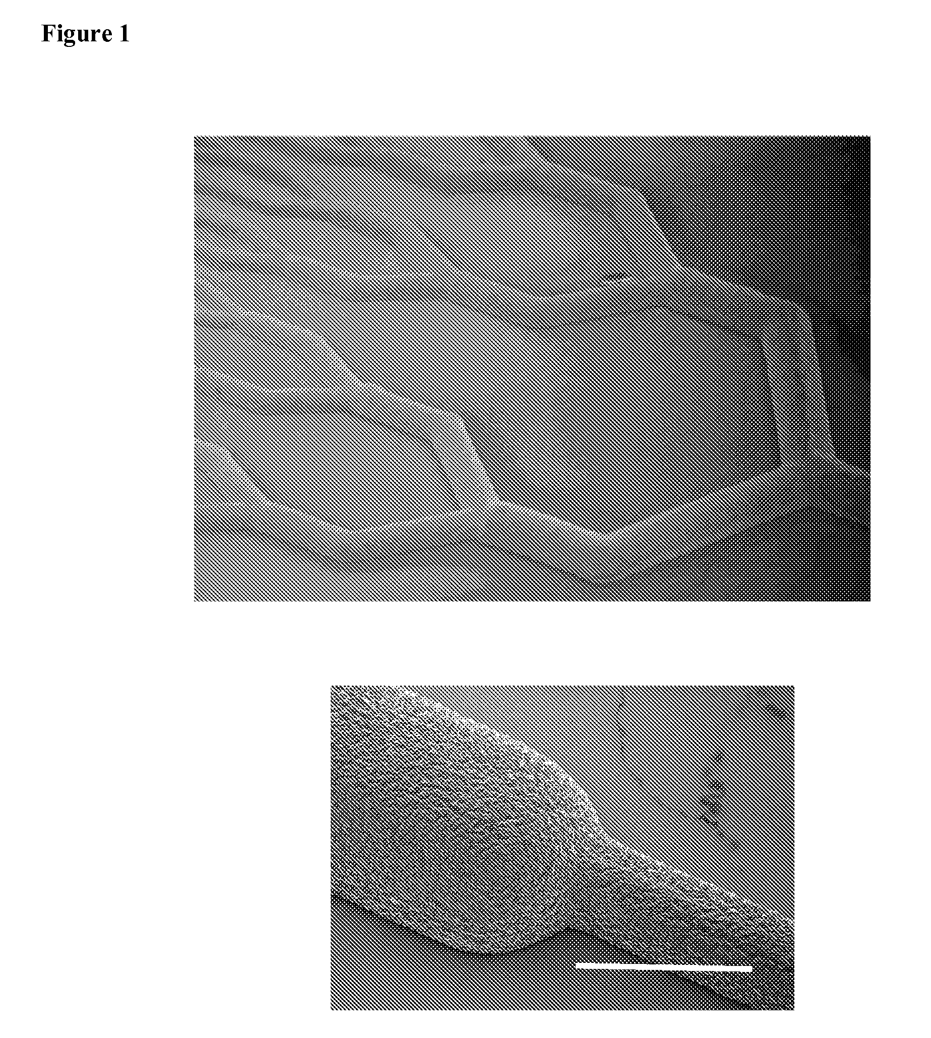 Microfabricated artificial lung assist device, and methods of use and manufacture thereof