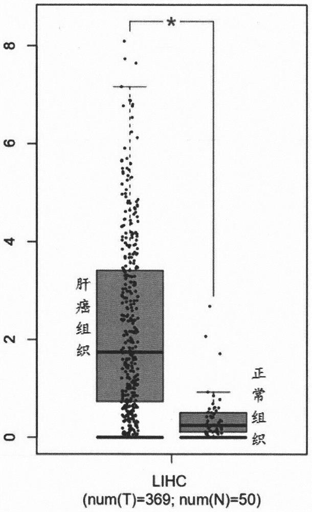 Application of LYPD1 in diagnosis, treatment, prognosis and recurrence prediction of hepatocellular carcinoma