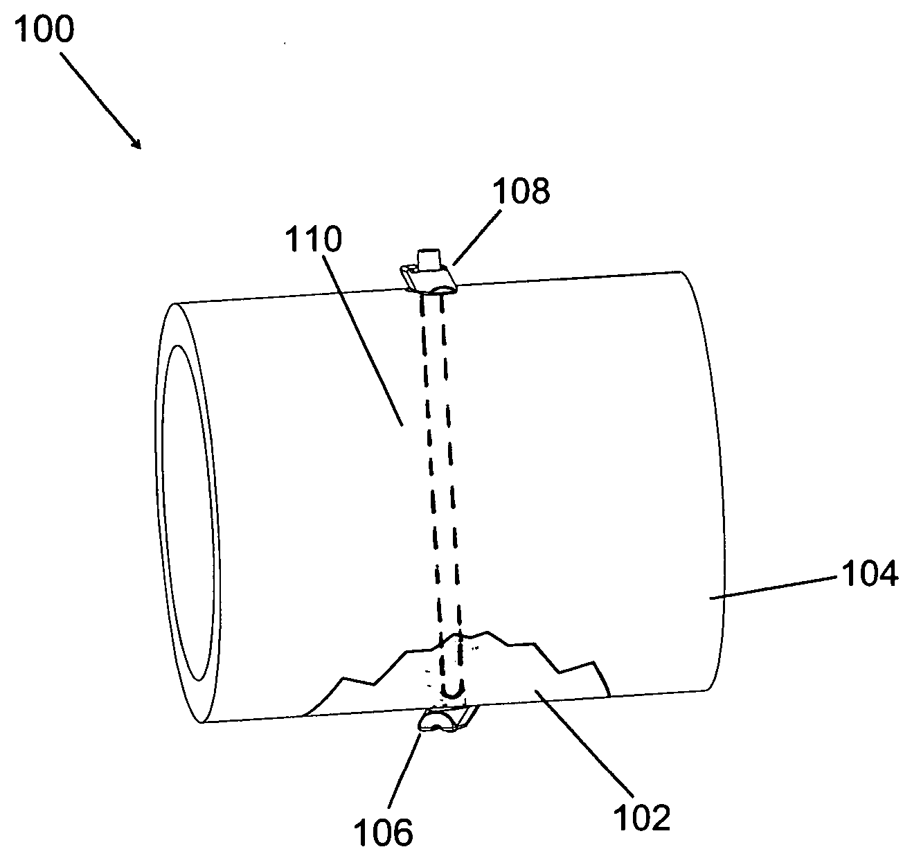 Tissue fixation system and method