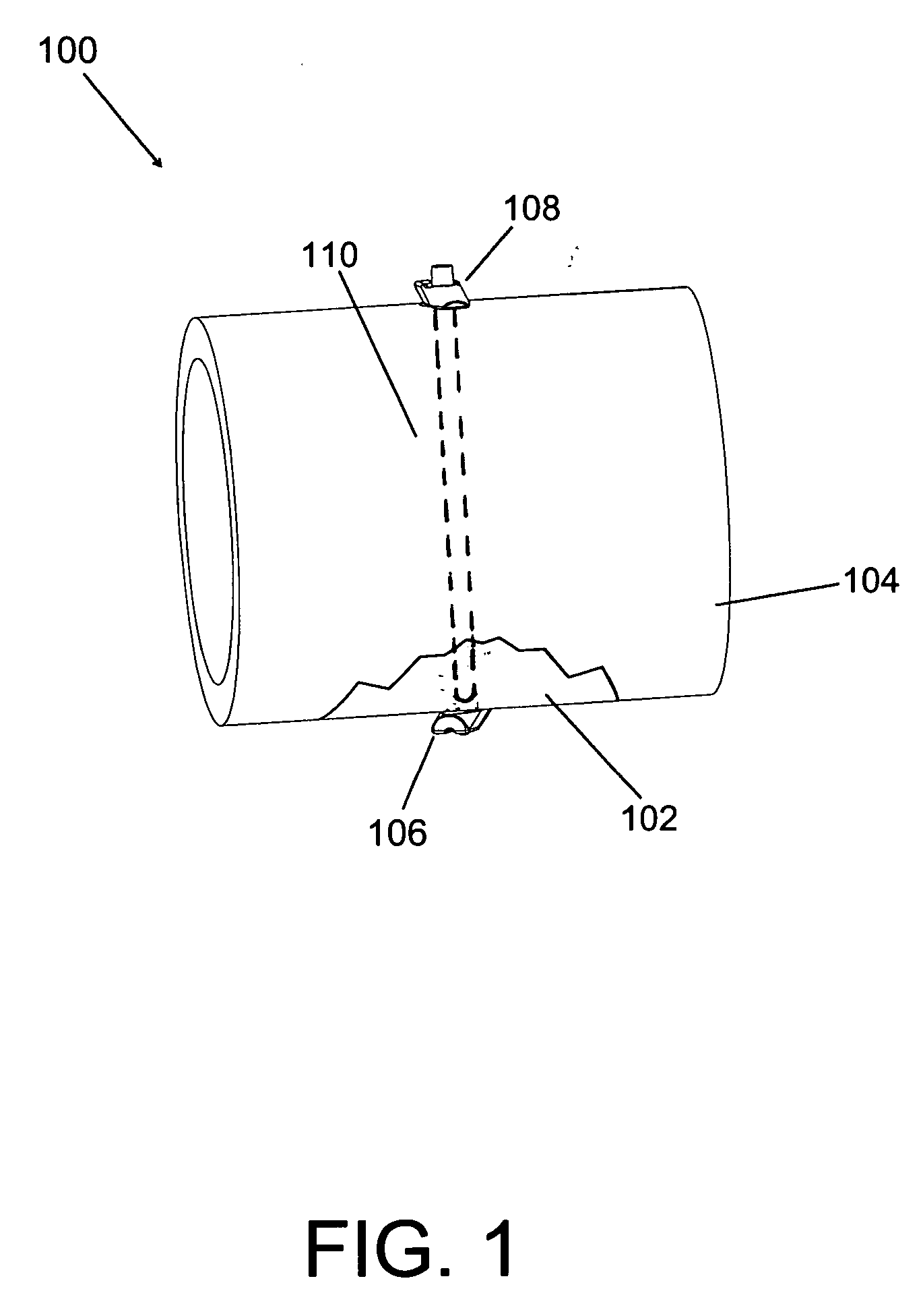 Tissue fixation system and method