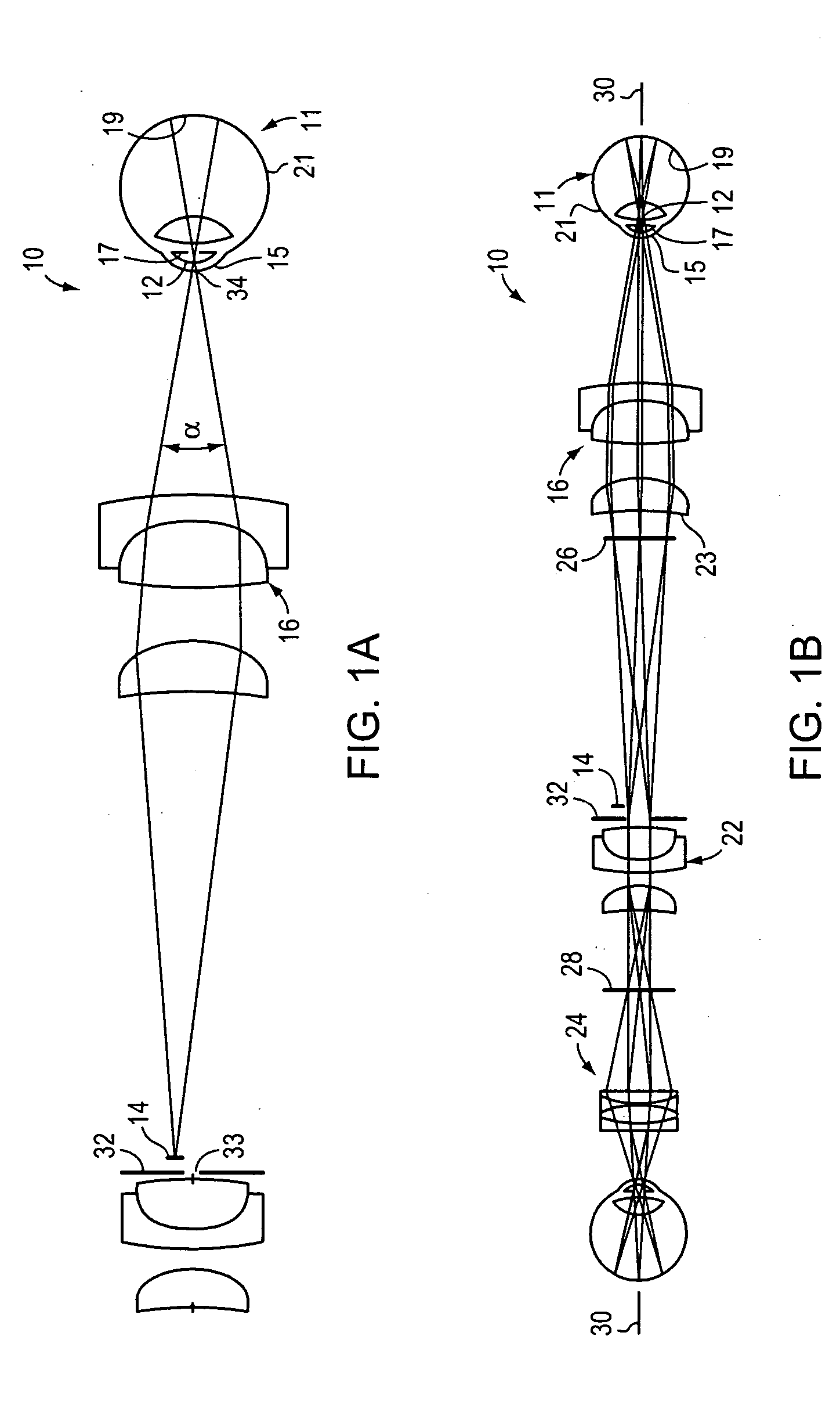 Digital documenting ophthalmoscope