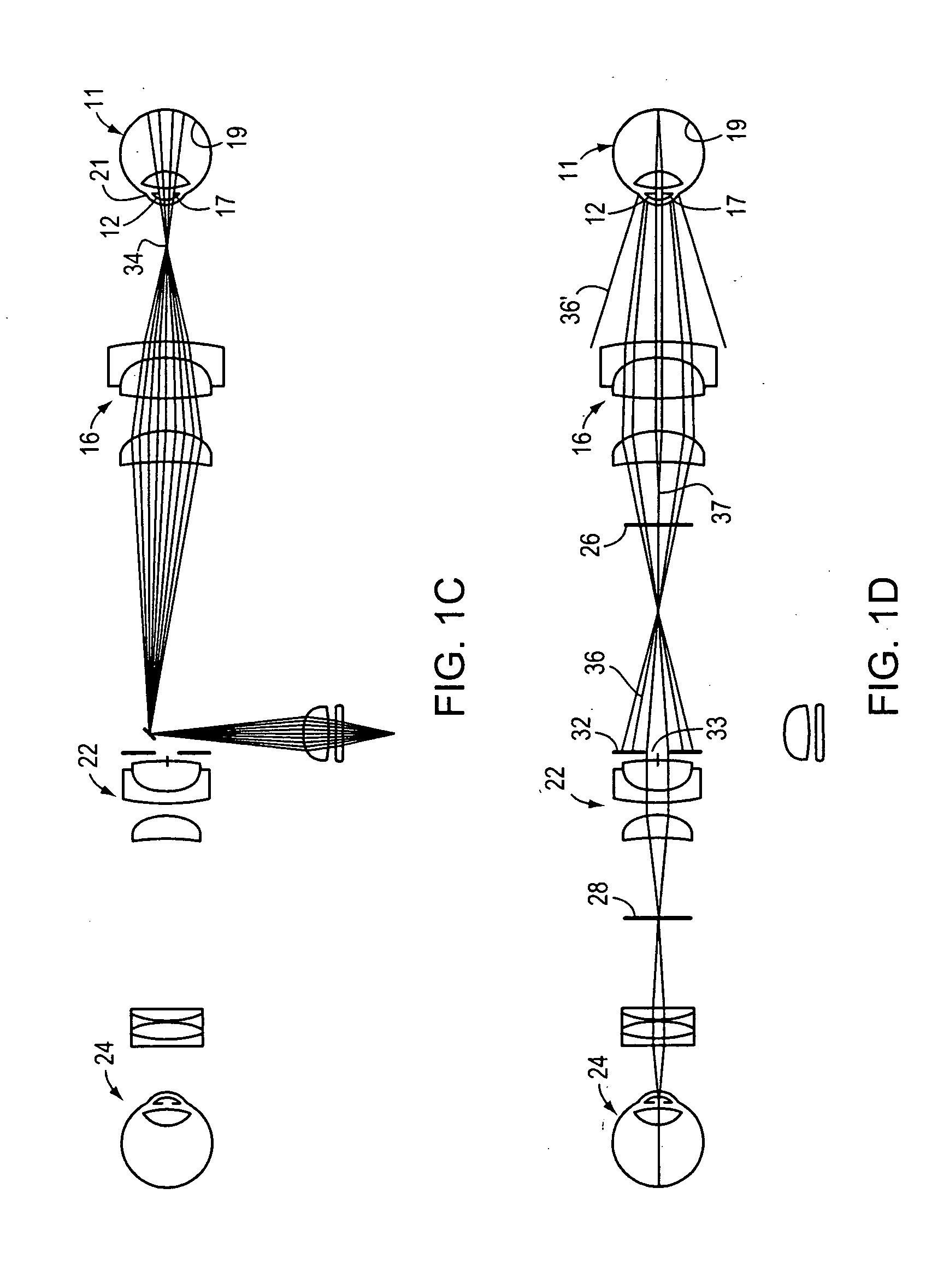 Digital documenting ophthalmoscope