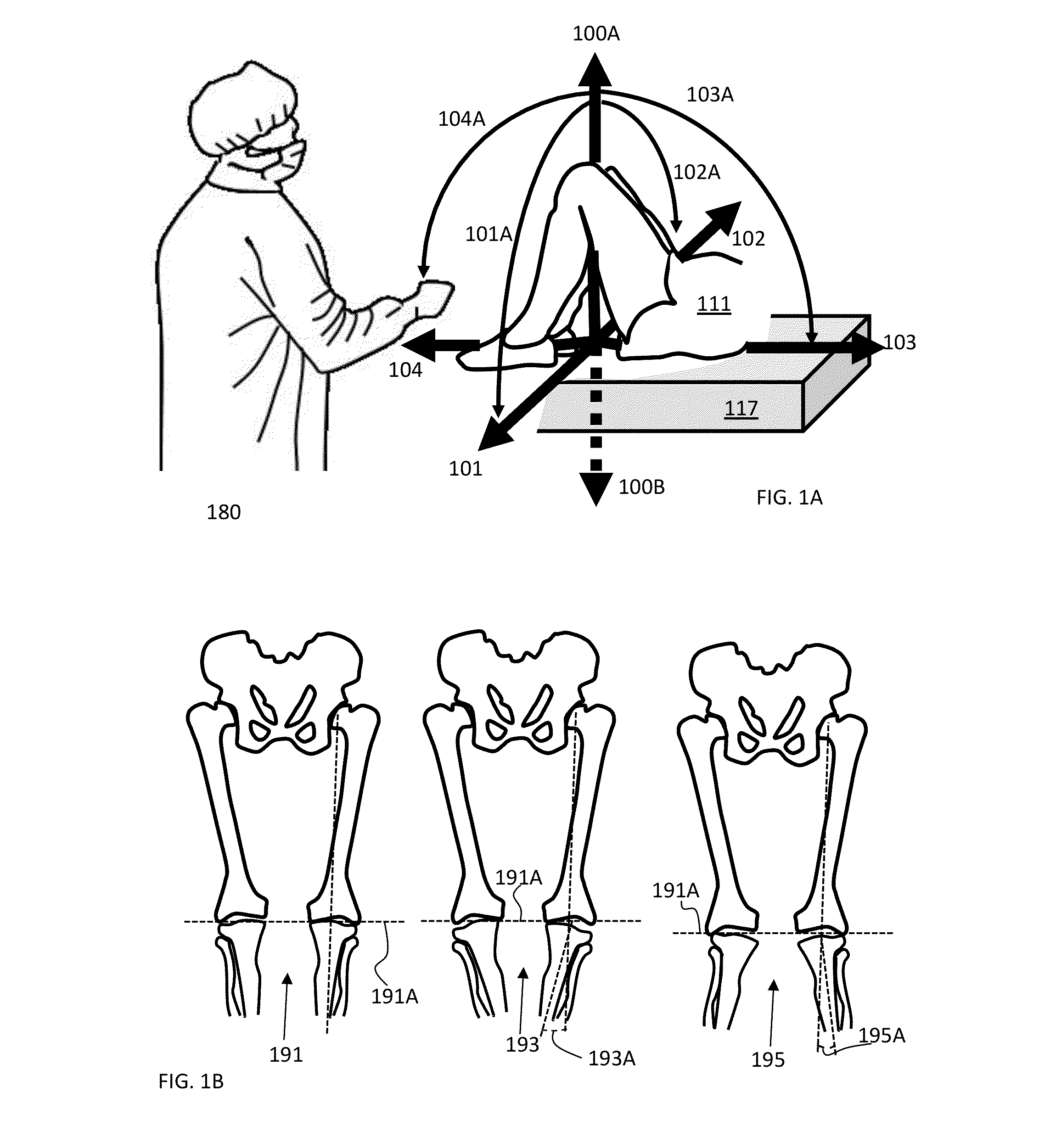 Bone cutting system for alignment relative to a mechanical axis