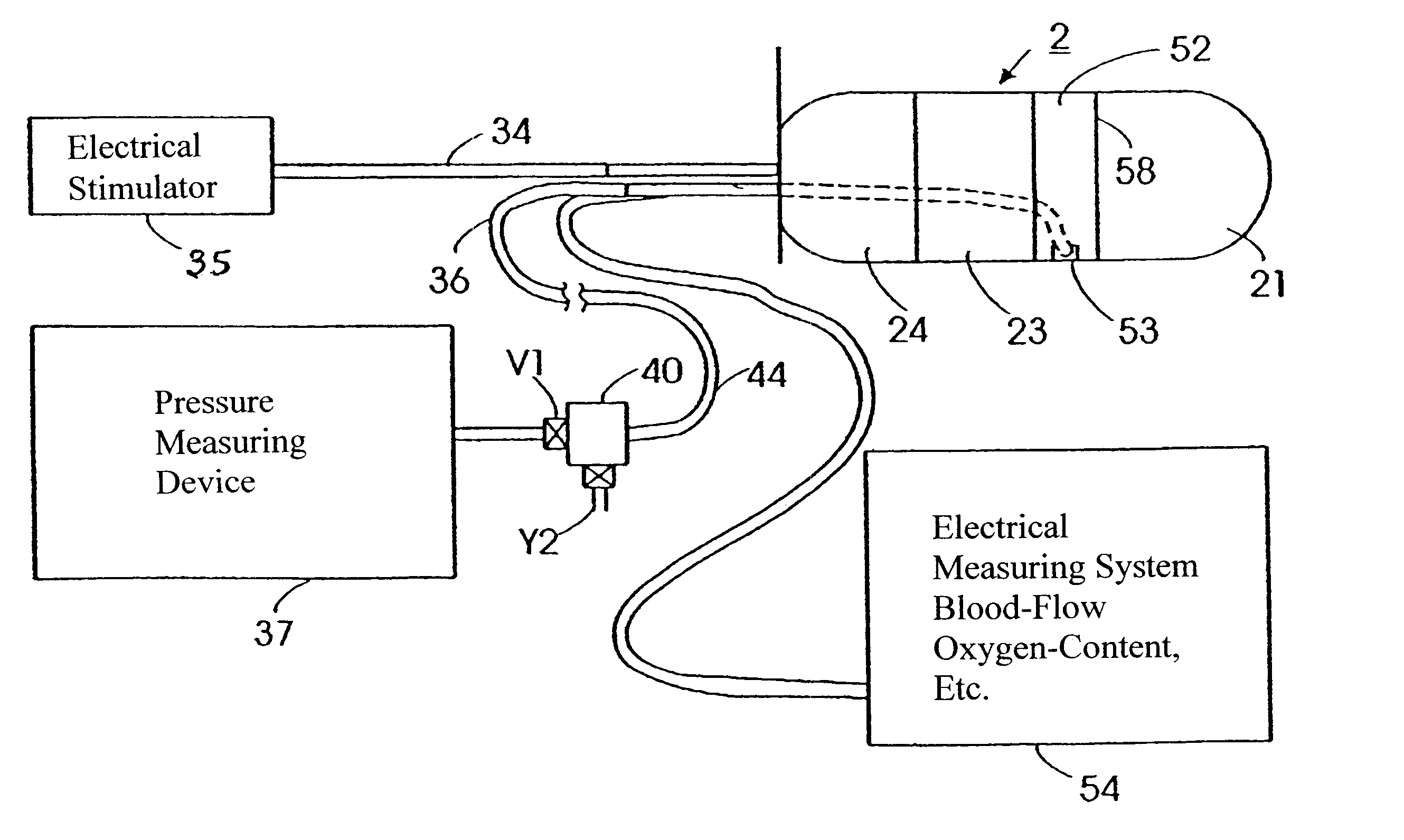 Body-cavity probe with body conformable member