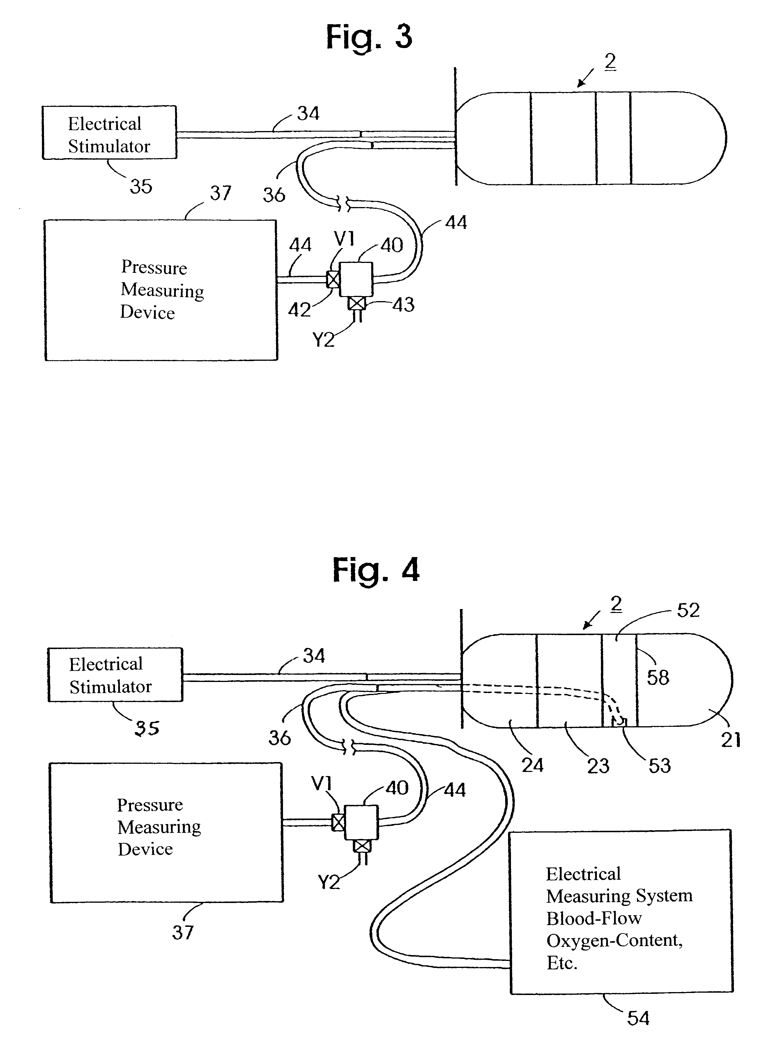 Body-cavity probe with body conformable member