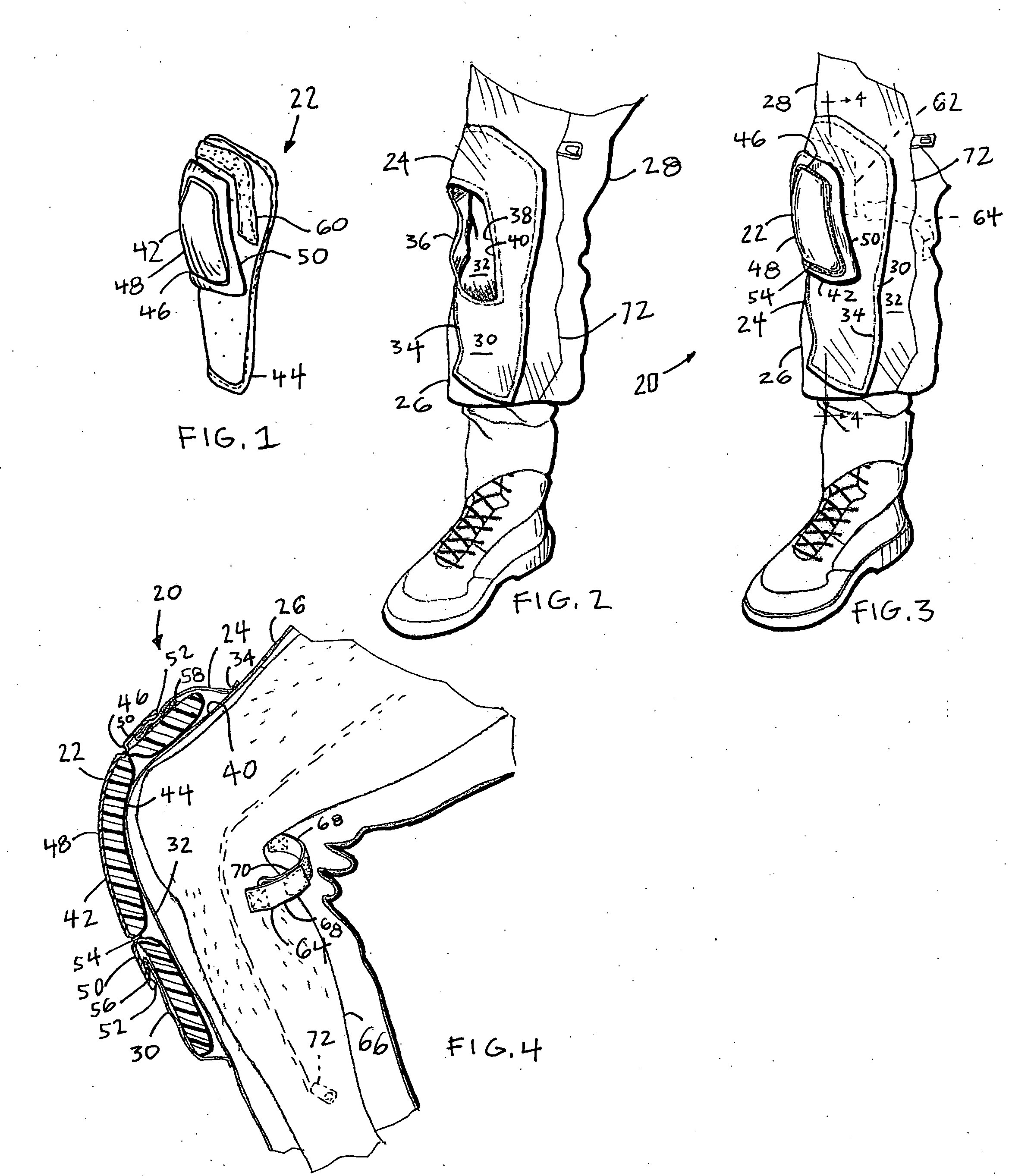 Removable garment protective assembly