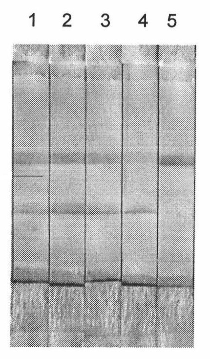 Constant temperature amplification detection kit and method for detecting food allergen crustacean gene