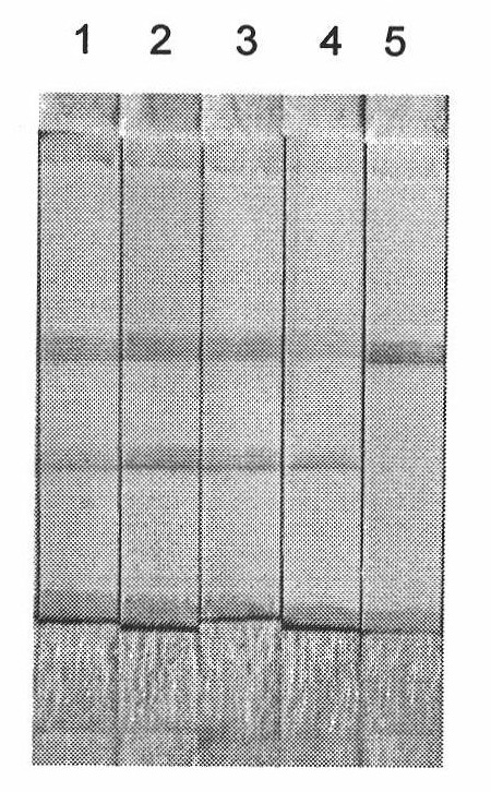 Constant temperature amplification detection kit and method for detecting food allergen crustacean gene