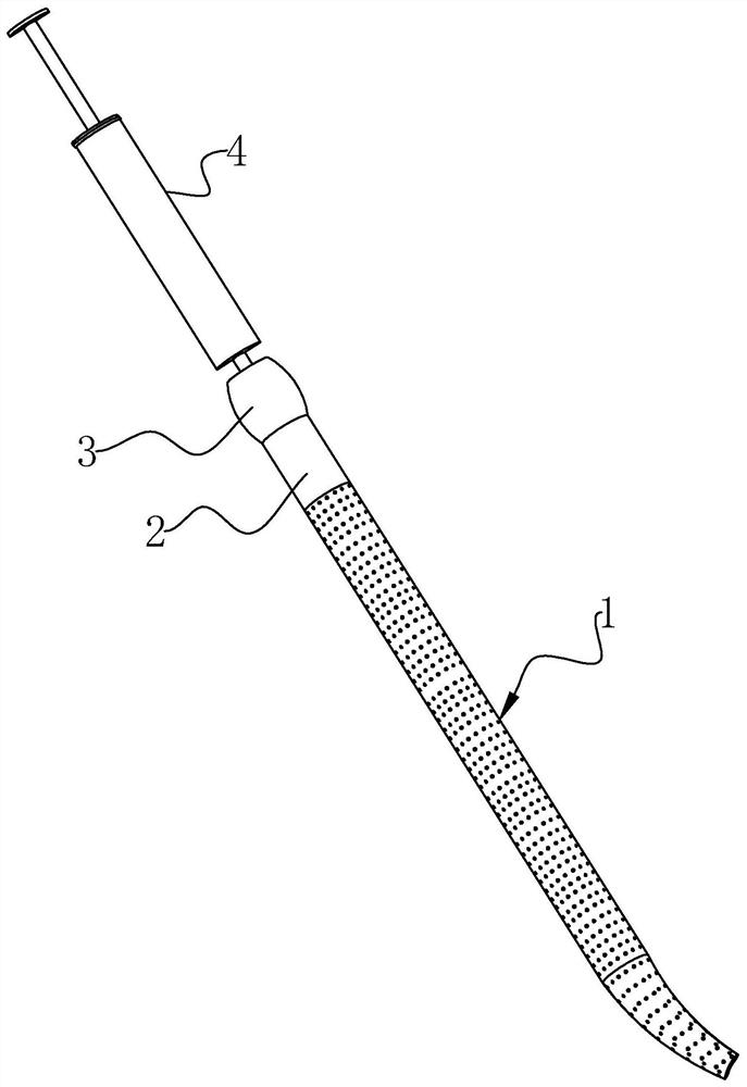 Disposable Injectable Cervical Dilation Rod