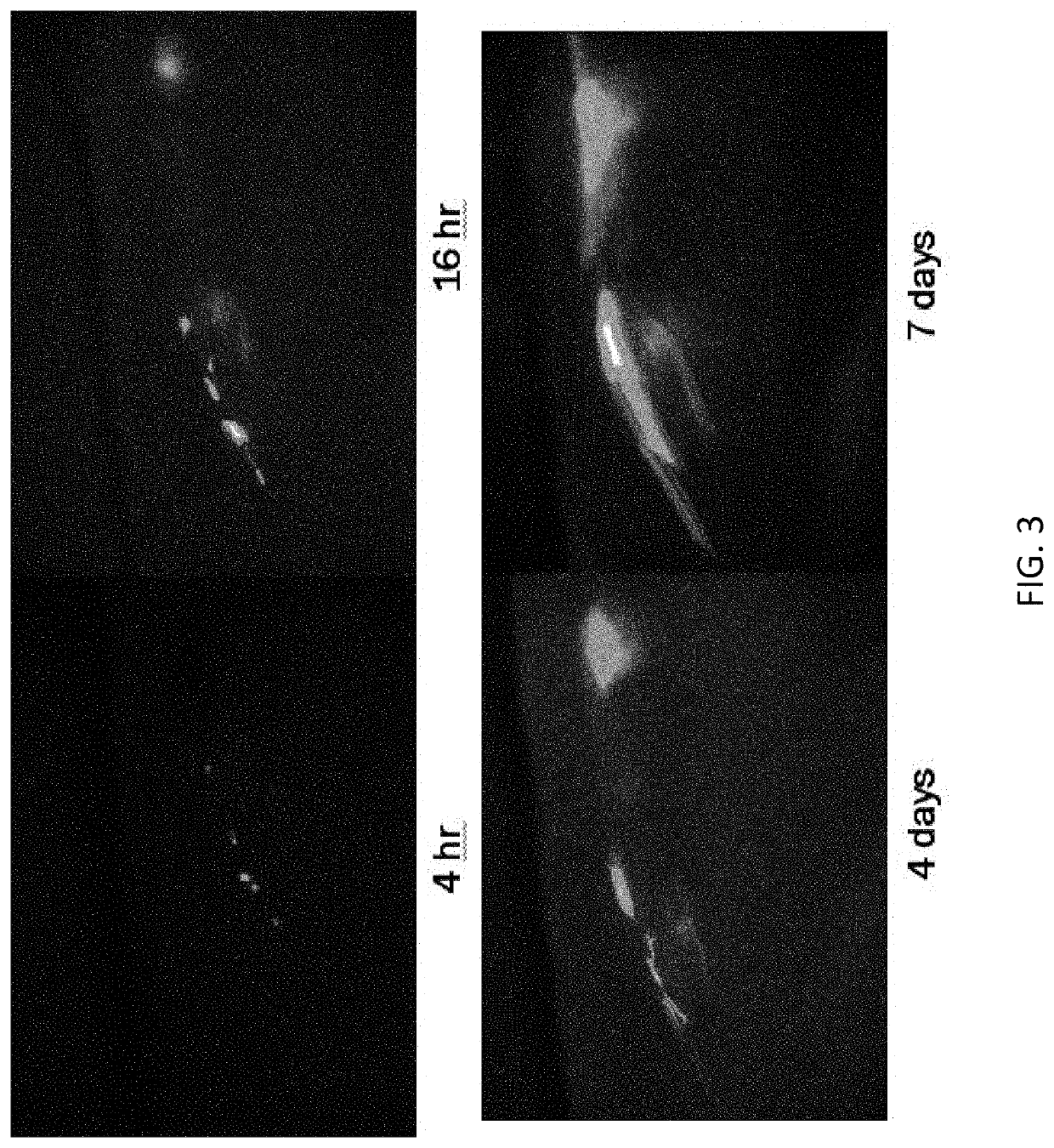 Methods and agents that enhance myogenic progenitor cell engraftment