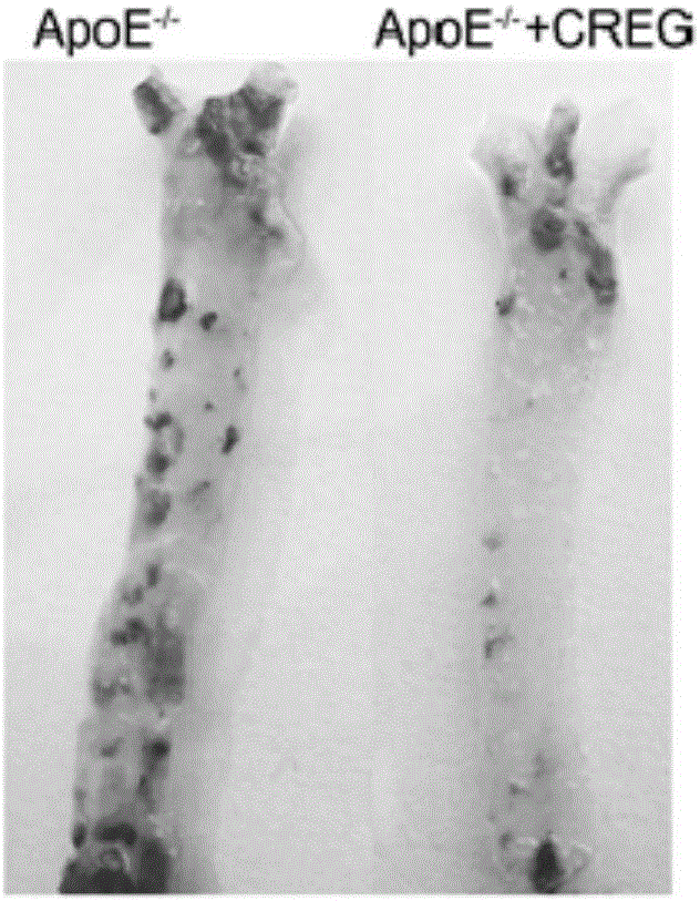 Novel application of recombinant hCREG glycoprotein and application thereof on coronary stent