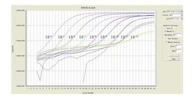 Universal shell type fluorescent reverse transcription-polymerase chain reaction (RT-PCR) detection method of bird flu virus and detection kit