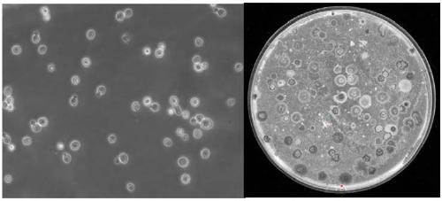 Method for counting bacterial colonies in fermented feed