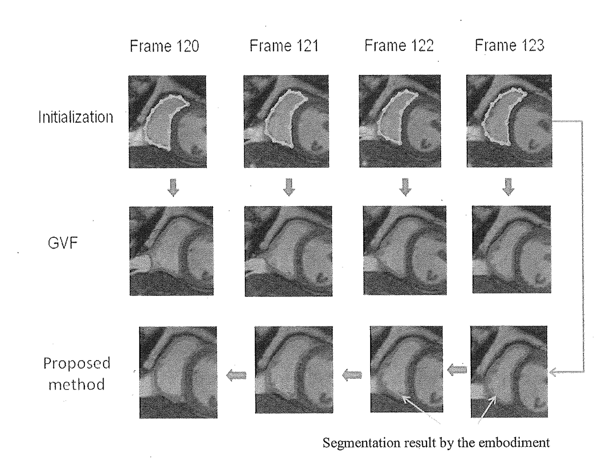 Segmentation of cardiac magnetic resonance (CMR) images using a memory persistence approach