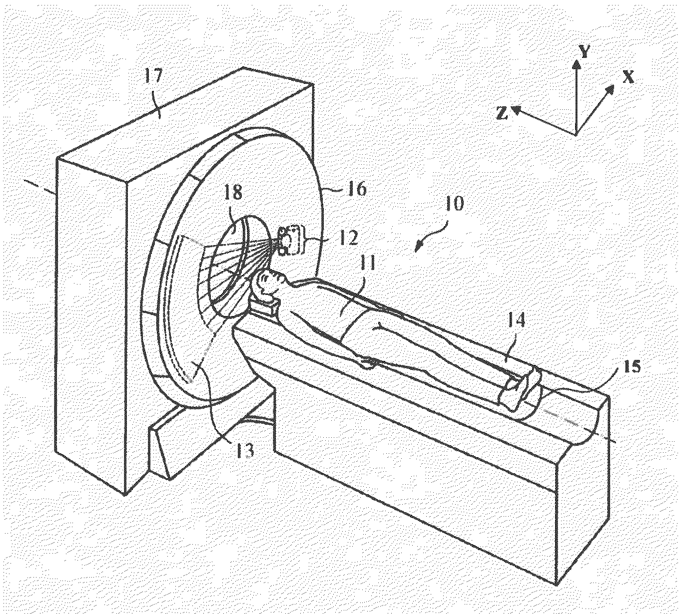 Automatic detection of patient body profile and intelligent positioning of patient