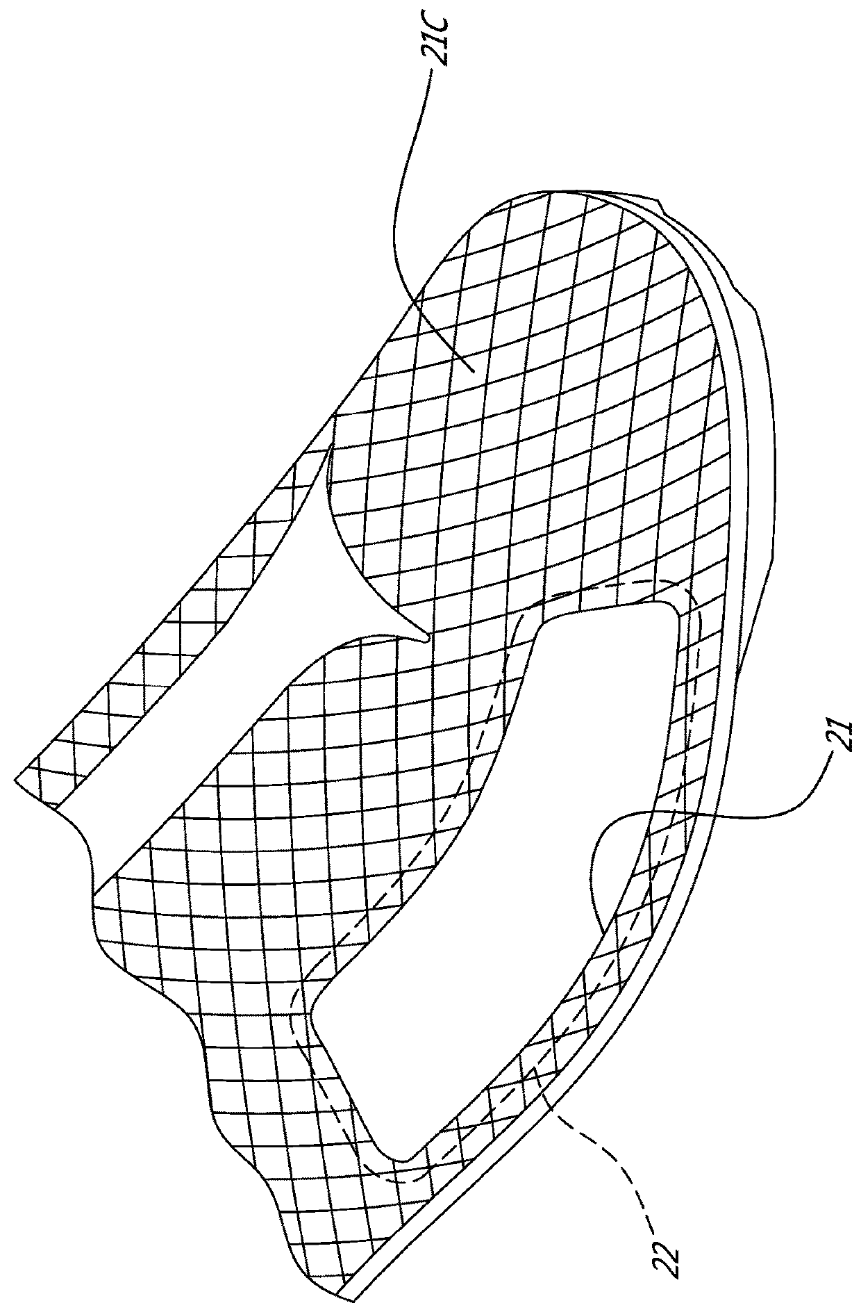 Cycling shoe with lateral metatarsal expansion zone